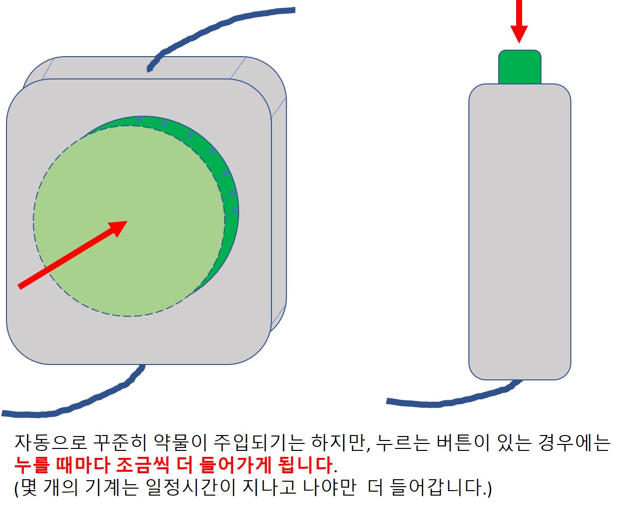 임신준비-무통분만-그림8.jpg